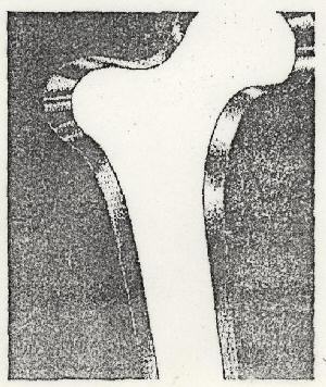 Zometa (device) Device mark 894413 Trademark