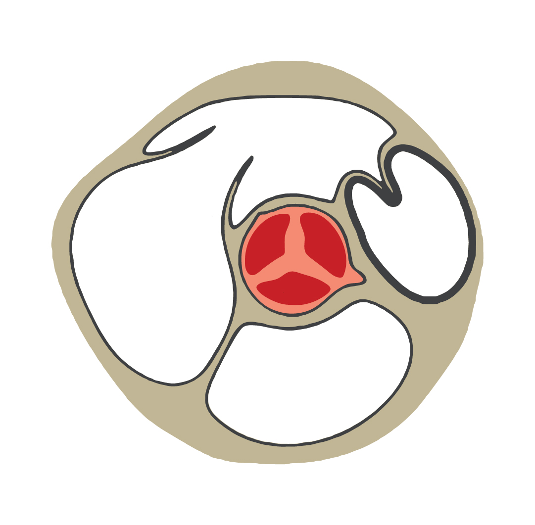 Logo Of Heart Valve Device mark 5282713 Trademark