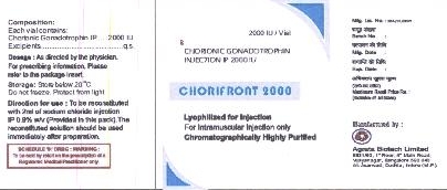 Chorifront 2000 Device mark 2017793 Trademark